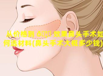 从价格到 🦍 效果鼻头手术如何选材料(鼻头手术大概多少钱)